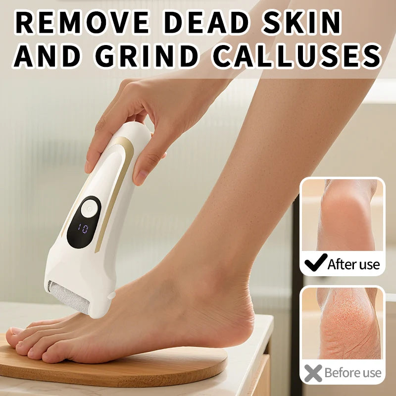 USB Powered Rechargeable Electric Foot Grinder Callus Remover Adjustable Speeds Pedicure Tool for Men & Women Personal Foot Care