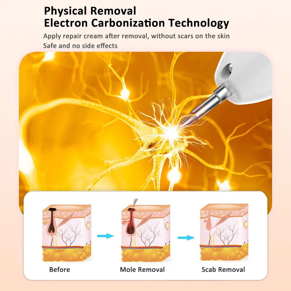 Laser Plasma Pen Remover Facial Mole Skin Tag Dark Spot Rechargeable Plasma Pen Warts Nevus Tattoo Freckle Papilloma Removal